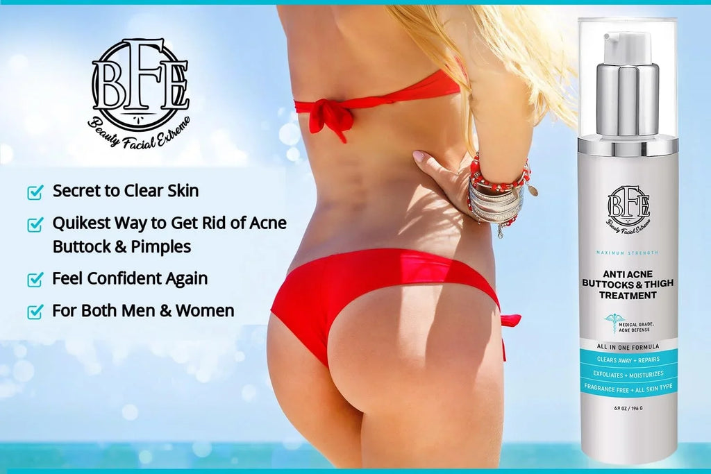 6.9 OZ. Prevents Future Breakouts. Anti-Acne Buttocks & Thigh Treatment- Clears Away Acne, Pimples, and Ingrown Hairs for the Buttocks and Thigh Area