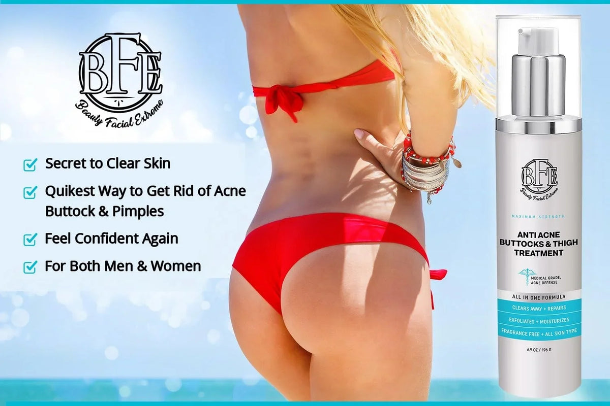 6.9 OZ. Prevents Future Breakouts. Anti-Acne Buttocks & Thigh Treatment- Clears Away Acne, Pimples, and Ingrown Hairs for the Buttocks and Thigh Area