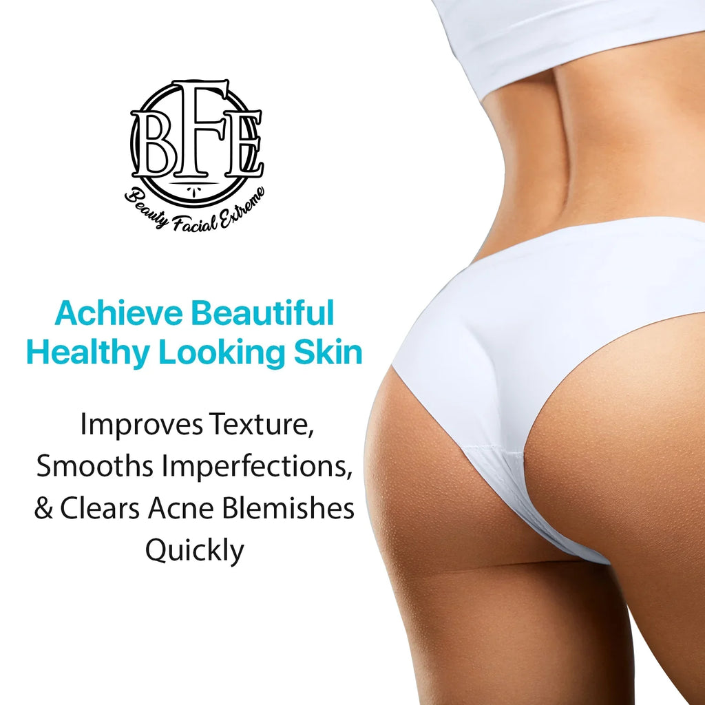 6.9 OZ. Prevents Future Breakouts. Anti-Acne Buttocks & Thigh Treatment- Clears Away Acne, Pimples, and Ingrown Hairs for the Buttocks and Thigh Area